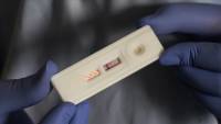 Highly virulent HIV variant discovered in Netherlands