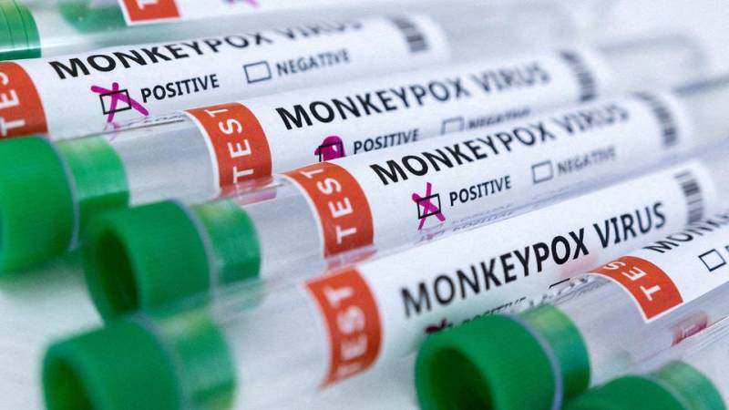India announces Asia's first monkeypox death