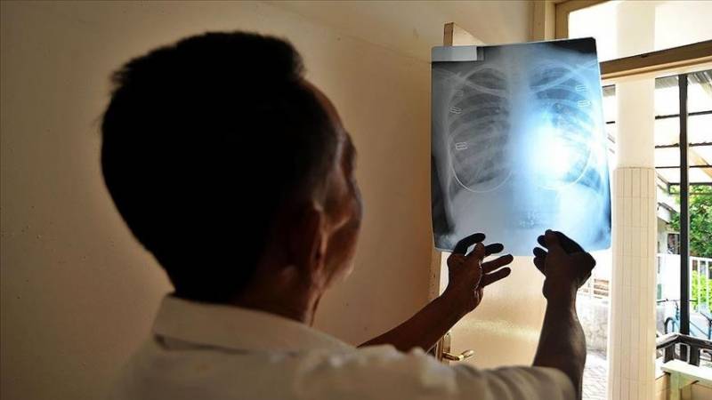WHO reports increase in tuberculosis deaths for 1st time in more than decade