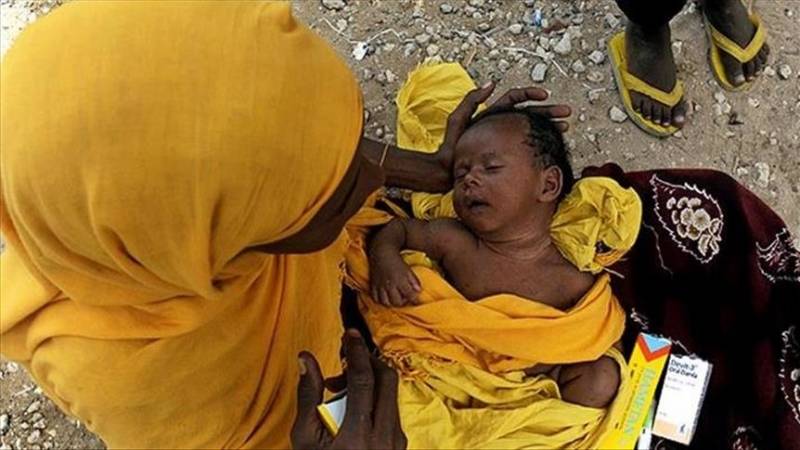 UN warns malnutrition may trigger 'explosion of child deaths' in Horn of Africa