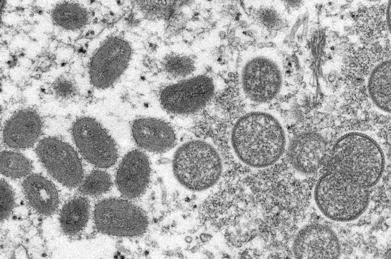Monkeypox: 9 dead in Congo, first death in Nigeria in 2022