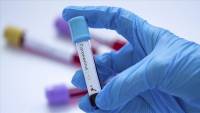 Coronavirus cases, deaths rise in Tunisia, Lebanon