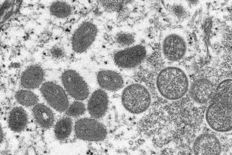 Massachusetts Identifies First 2022 U.S. Case of Monkeypox Infection